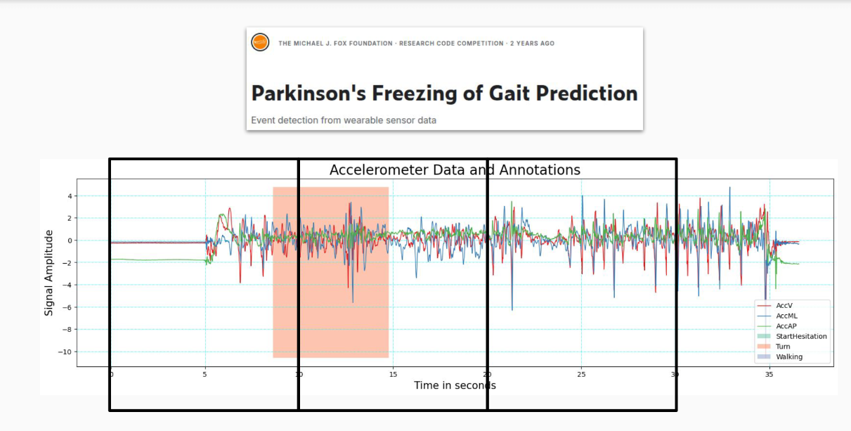 Automated Detection of Freezing of Gait in Parkinson's Disease from Accelerometer Data